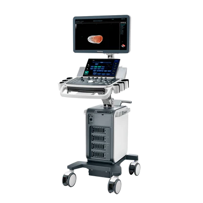 Ecógrafo Mindray de alta resolución utilizado para ecotomografías en Centro Radiológico Nataniel Cox