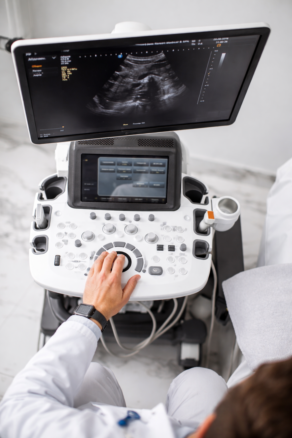 Profesional médico operando ecógrafo de alta resolución en el Centro Radiológico Nataniel Cox, Santiago Centro